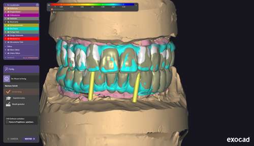 Design mit Vollanatomie