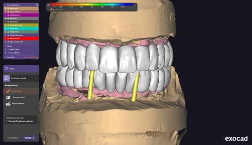 Fertige Konstruktion