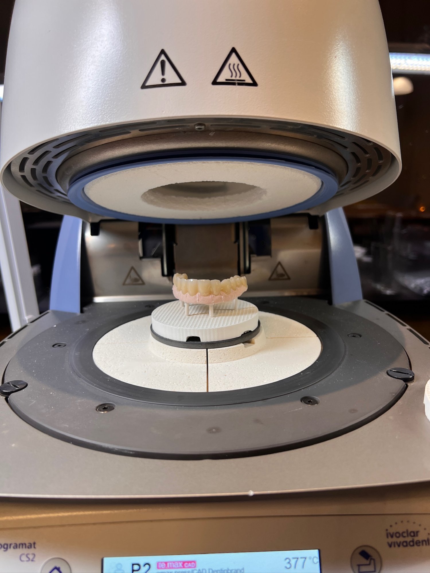 Weitere Arbeiten – Brücke auf Modell