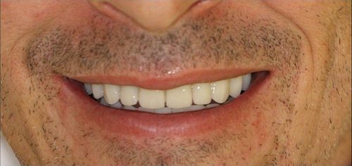 Gesamtsanierung OK – Nachher