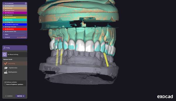 OK Herstellung – Frontalansicht