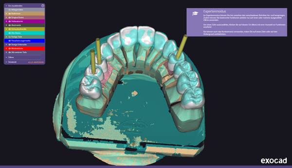 OK Herstellung – Okklusalansicht