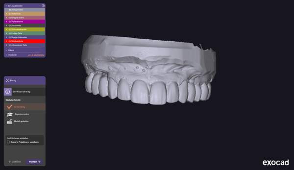 OK Modell nach Einsetzen – Ansicht 1