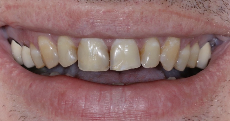 Totalsanierung – Vorher