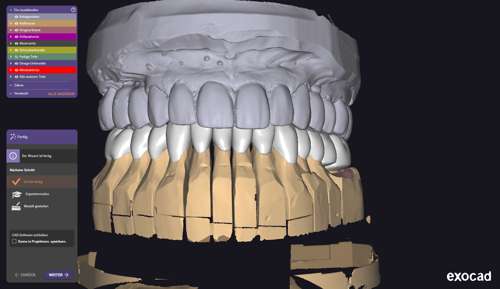 UK Herstellung – Frontalansicht