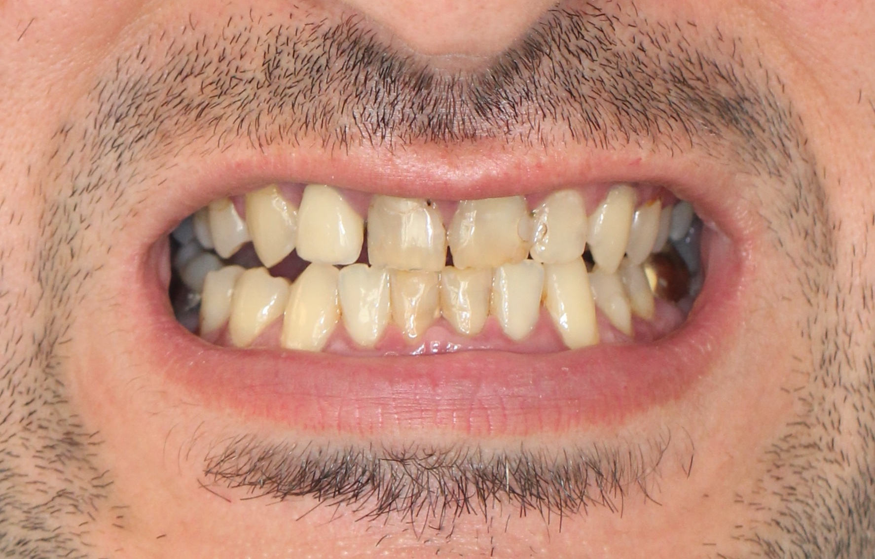 Ästhetische Totalsanierung – Vorher