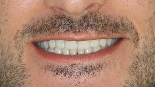 Ästhetische Totalsanierung – Nachher 1