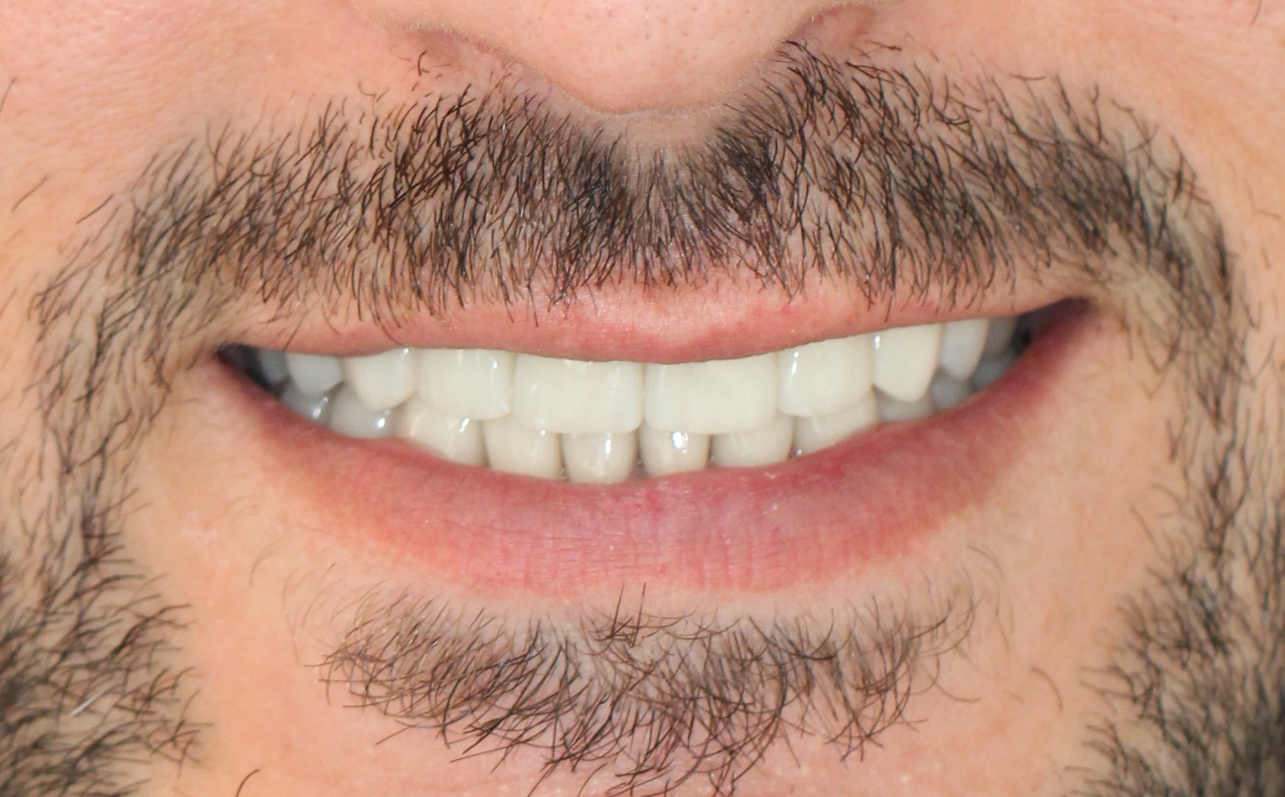 Ästhetische Totalsanierung – Nachher 2