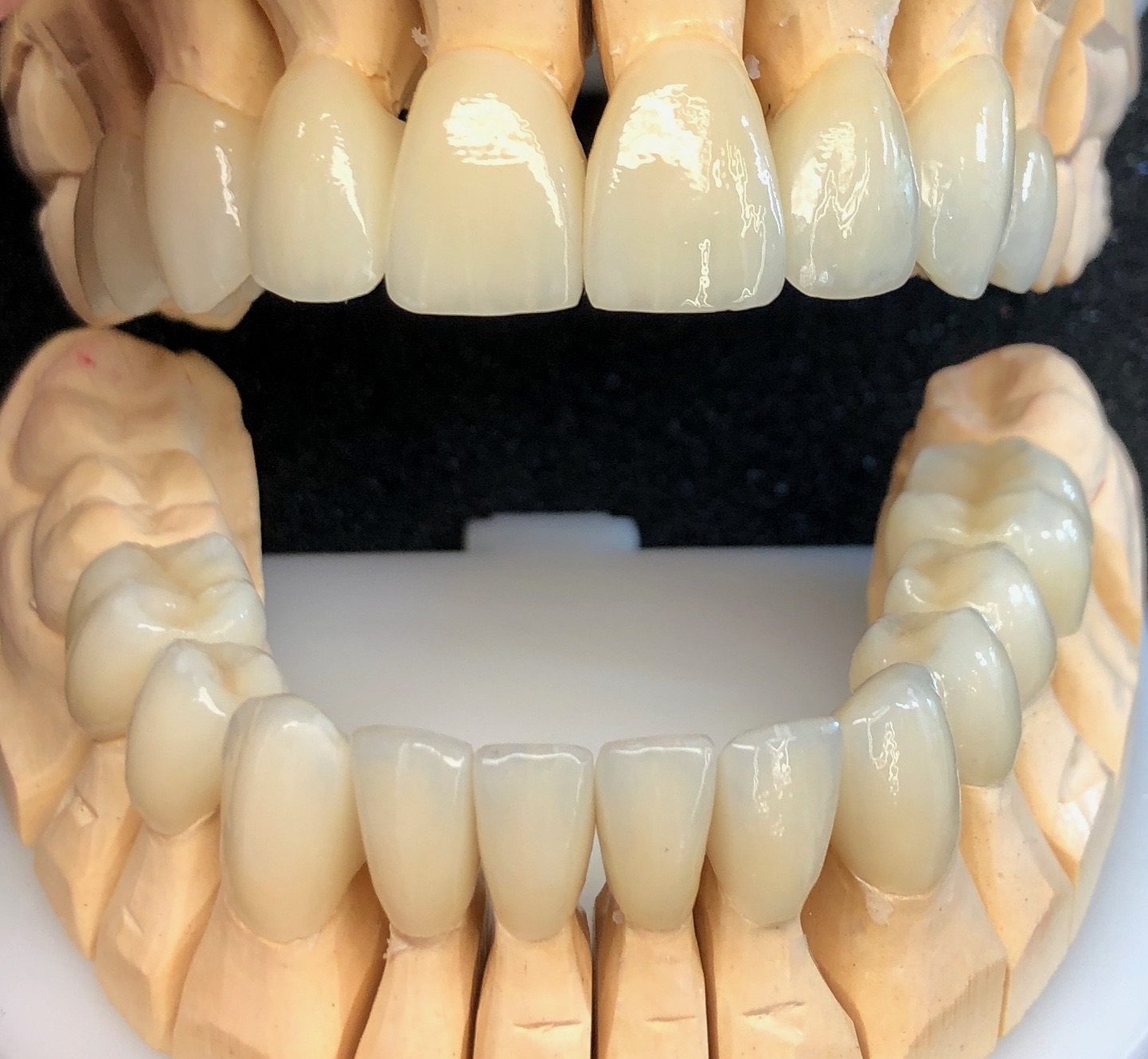 Modellsituation frontal