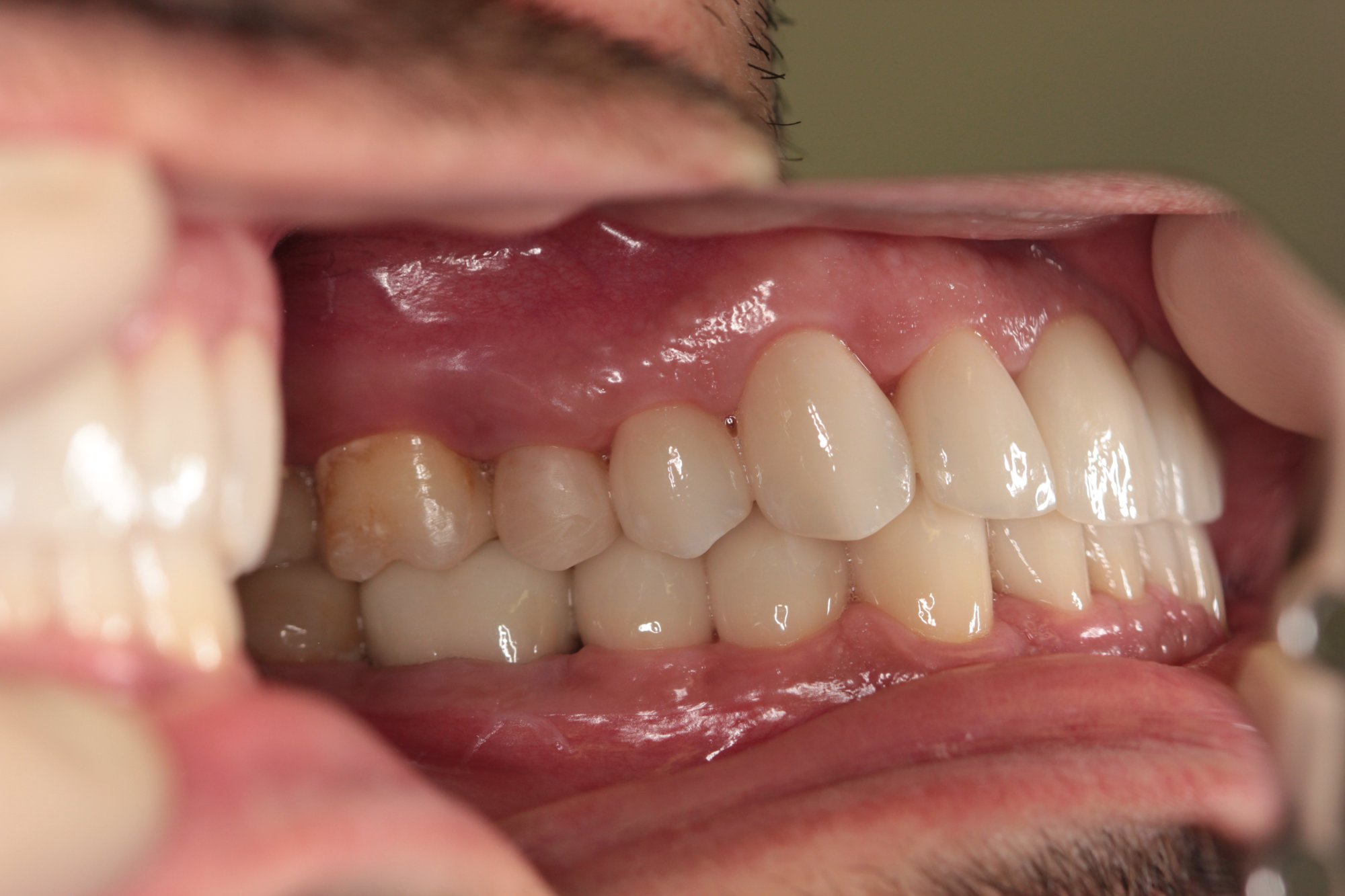 Seitliche Ansicht links