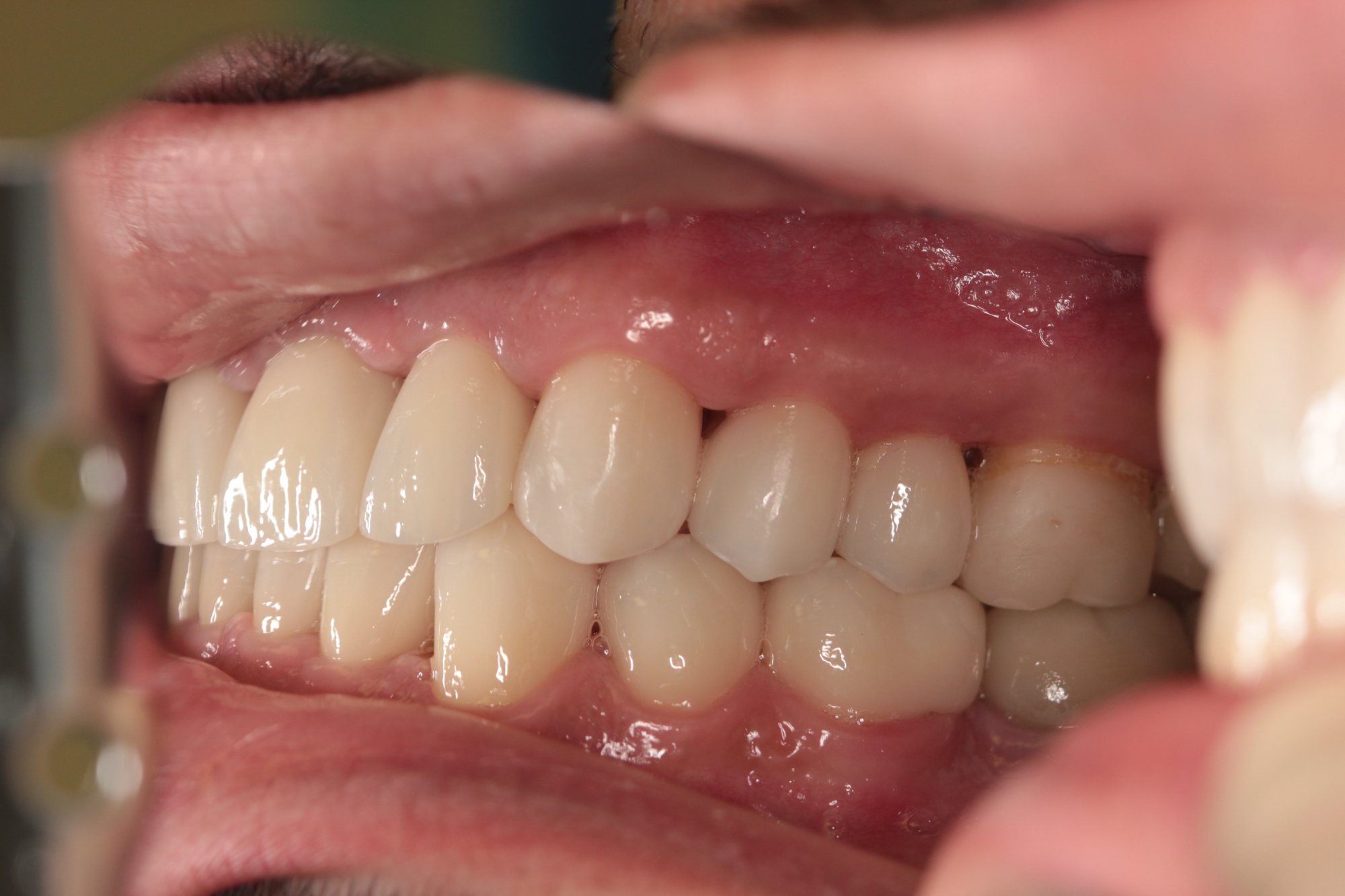 Seitliche Ansicht rechts