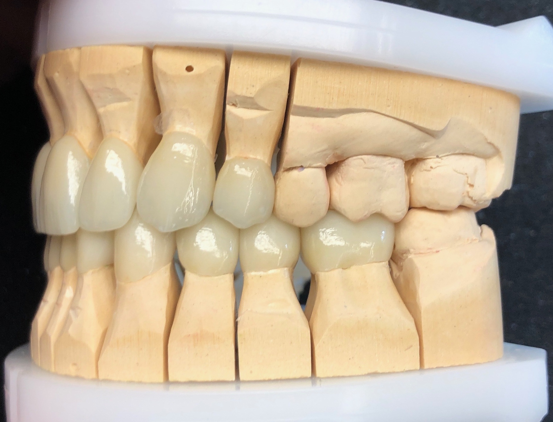 Modellsituation seitlich