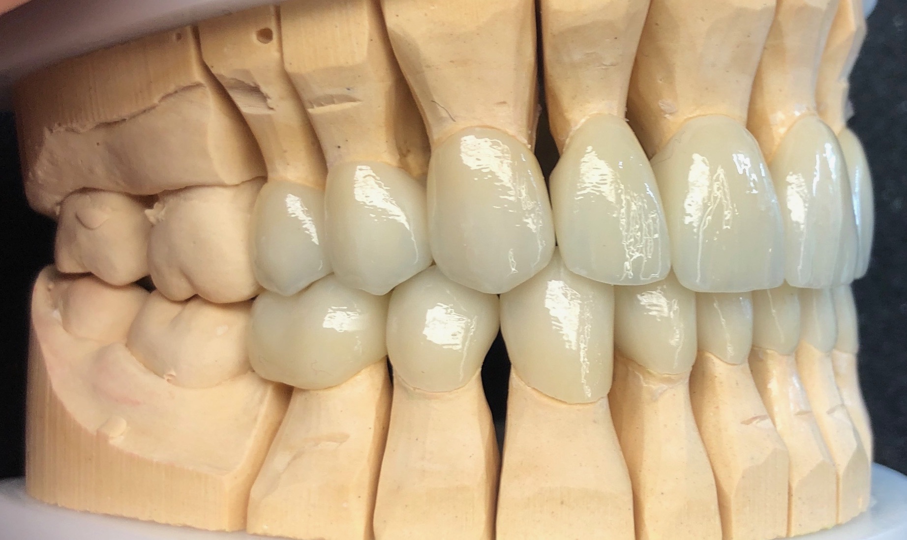 Modellsituation frontal Detail