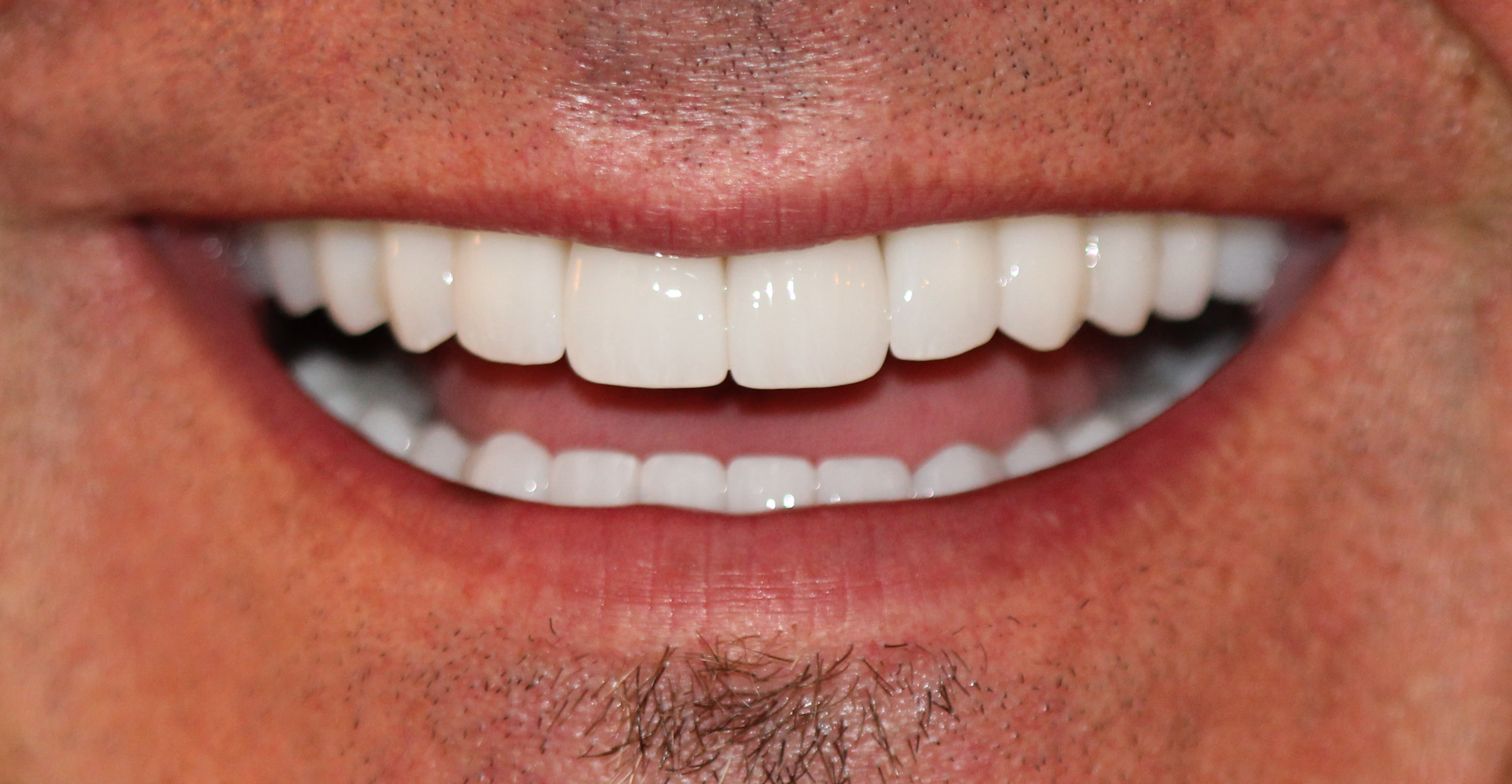 Gesamtsanierung – Patientenlächeln 1