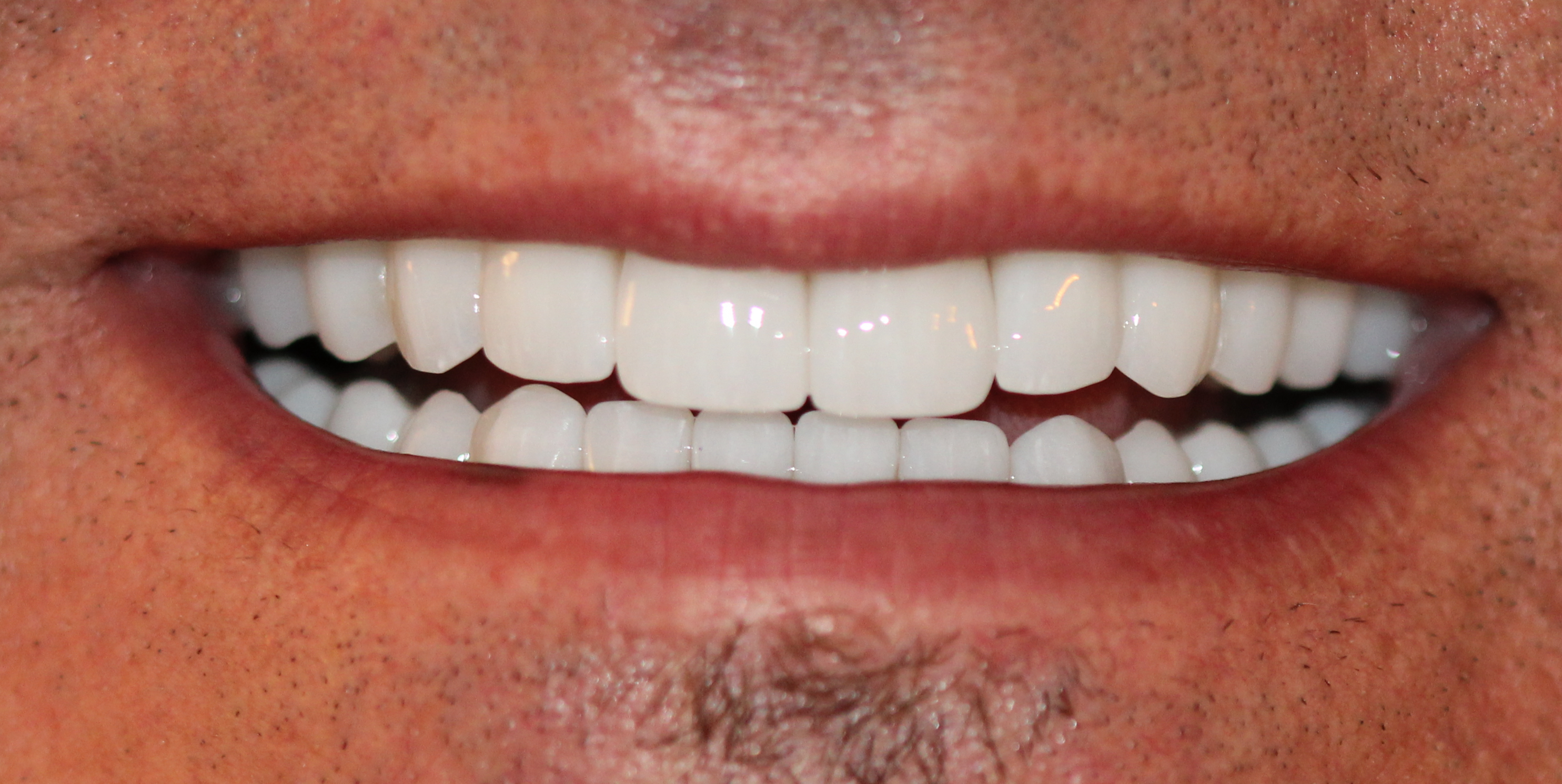 Gesamtsanierung – Patientenlächeln 2